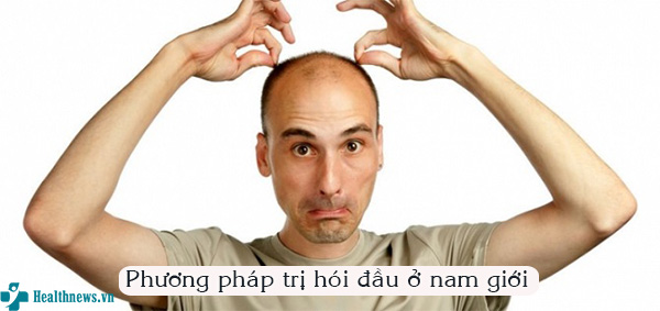 Bật mí 3 phương pháp trị hói đầu ở nam giới hiệu quả nhất