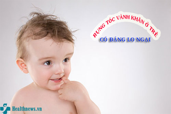 Rụng tóc vành khăn ở trẻ có đáng lo ngại?