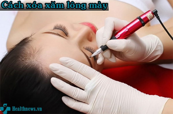 Tổng hợp những cách xóa xăm lông mày hiệu quả, an toàn và dễ thực hiện