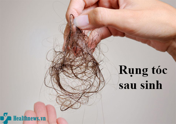 Rụng tóc sau sinh: Nguyên nhân và cách khắc phục hiệu quả