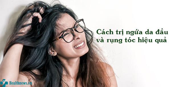 5 cách trị ngứa da đầu và rụng tóc hiệu quả