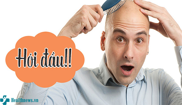 Giải đáp thắc mắc: Hói đầu có chữa được không?