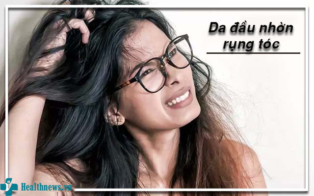 Giải đáp thắc mắc: Da đầu nhờn rụng tóc phải làm sao?