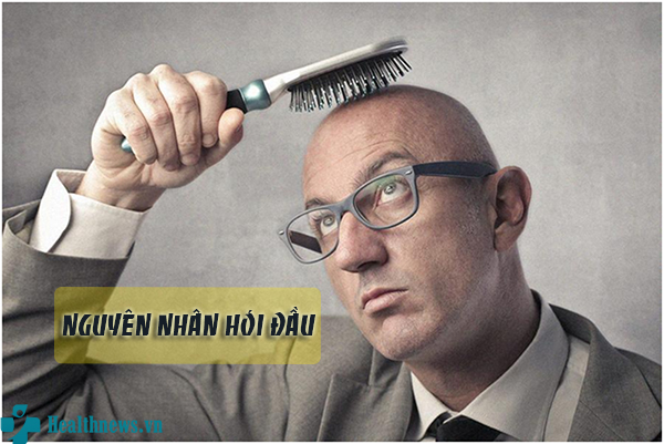 Nguyên nhân gây hói đầu phổ biến không phải ai cũng biết