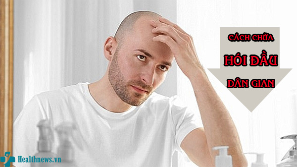 4 cách chữa hói đầu dân gian vô cùng đơn giản và hiệu quả ngay tại nhà