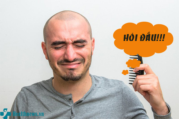 Tiết lộ 7 cách trị hói đầu hiệu quả nhất hiện nay