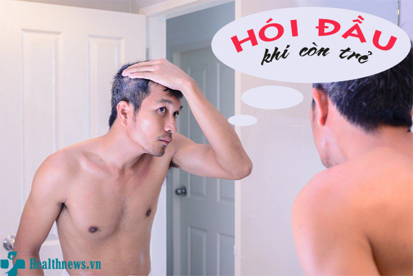 Bị hói đầu khi còn trẻ càng để lâu càng khó chữa
