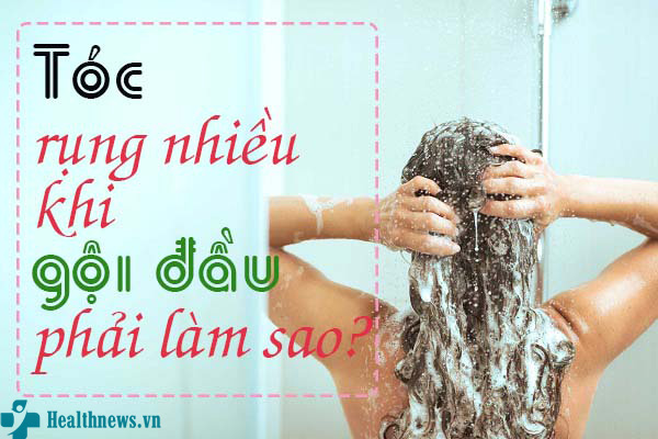 Rụng tóc nhiều khi gội đầu – Nguyên nhân và cách khắc phục