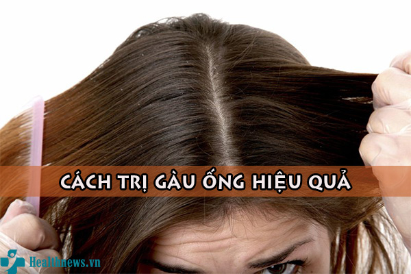 Gợi ý 3 cách trị gàu ống hiệu quả