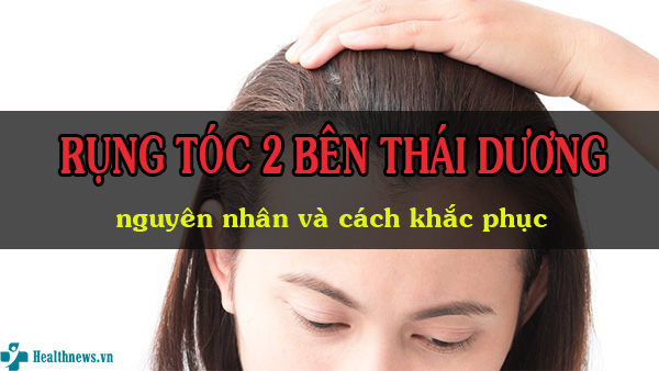 Rụng tóc 2 bên thái dương: Nguyên nhân và cách khắc phục