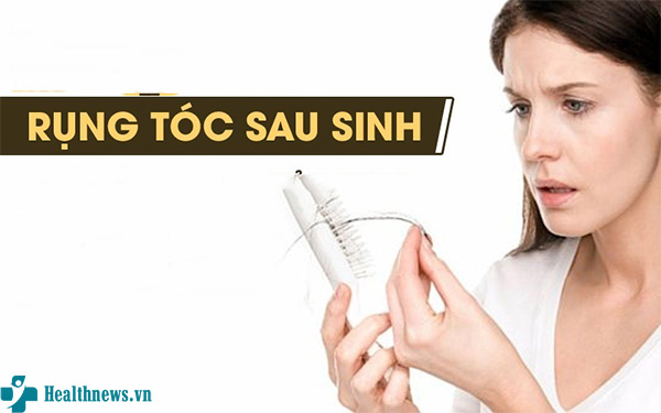 Giải đáp: Rụng tóc sau sinh bao lâu thì hết?