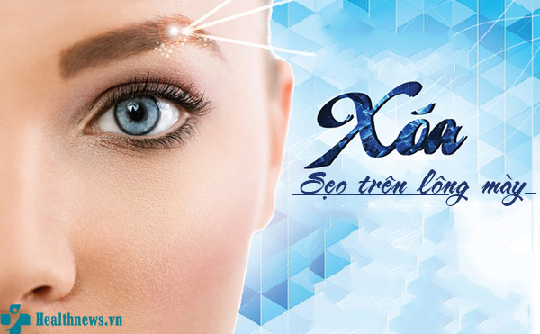 Gợi ý cách xóa sẹo trên lông mày cực kì hiệu quả