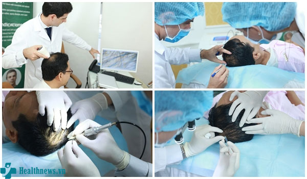 Cấy tóc ở 260 Nguyễn Đình Chiểu, Phường 06, Quận 03, TP HCM bao nhiêu tiền?