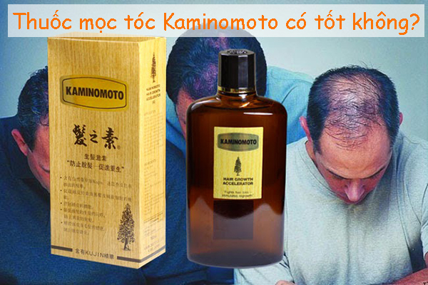 Thuốc mọc tóc Kaminomoto có tốt không
