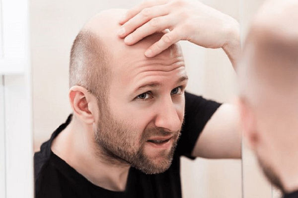 Lý do nam giới 40 tuổi bị rụng tóc 7 lý do rụng tóc cần đặc biệt chú ý