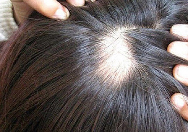 5 loại dầu gội giúp nàng chăm sóc tóc xoăn tự nhiên ngày hè  VeryGirlie