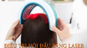 Goodhair DHT Blocker hỗ trợ kích thích mọc tóc cho người rụng tóc hói đầu   Báo Dân trí