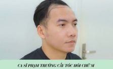 Ca sĩ Phạm Trưởng cấy tóc hói chữ M: Sự thay đổi nhỏ nhưng tác động lớn đến tâm lý người nghệ sĩ