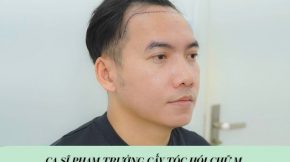 Ca sĩ Phạm Trưởng cấy tóc hói chữ M: Sự thay đổi nhỏ nhưng tác động lớn đến tâm lý người nghệ sĩ