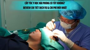 Cấy tóc Y học Hải Phòng có tốt không? Review chi tiết dịch vụ & chi phí mới nhất