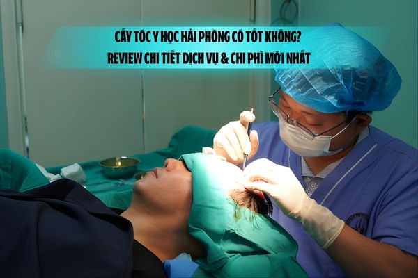 Cấy tóc Y học Hải Phòng có tốt không? Review chi tiết dịch vụ & chi phí mới nhất