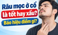 Râu mọc ở cổ là tốt hay xấu? Báo hiệu điềm gì?