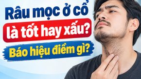 Râu mọc ở cổ là tốt hay xấu? Báo hiệu điềm gì?