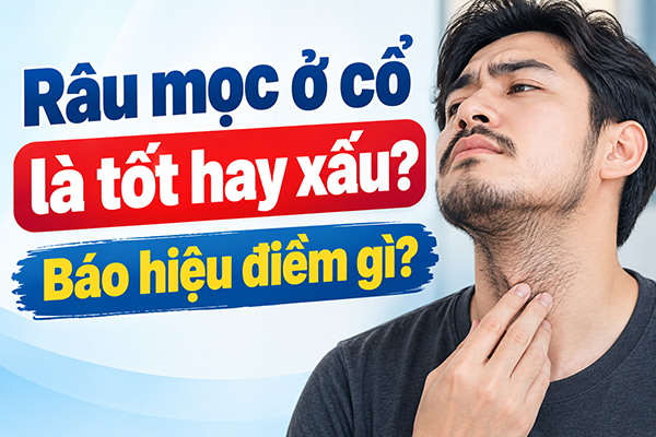 Râu mọc ở cổ là tốt hay xấu? Báo hiệu điềm gì?
