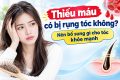 Thiếu máu có bị rụng tóc không? Nên bổ sung gì cho tóc khỏe mạnh