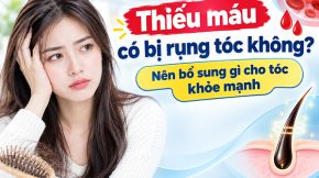 Thiếu máu có bị rụng tóc không? Nên bổ sung gì cho tóc khỏe mạnh