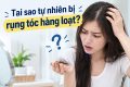 [Tìm Hiểu] : Tại sao tự nhiên bị rụng tóc hàng loạt?