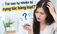 [Tìm Hiểu] : Tại sao tự nhiên bị rụng tóc hàng loạt?