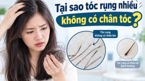 Tại sao tóc rụng không có chân tóc