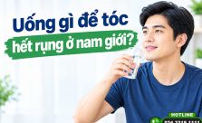 Uống gì để tóc hết rụng ở nam giới? Top 5 loại thuốc được ưu dùng