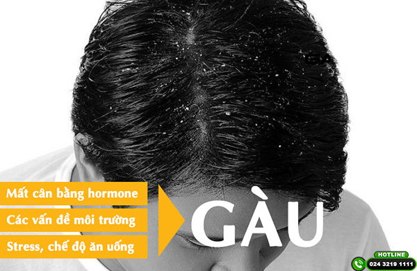 nguyên nhân gây ra gàu và rụng tóc