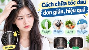 cách chữa tóc dầu đơn giản, hiệu quả