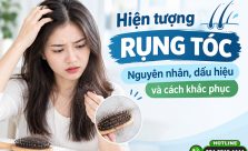 Hiện tượng rụng tóc: Nguyên nhân, dấu hiệu và cách khắc phục