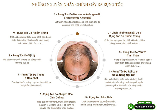 nguyên nhân rụng tóc ở nam giới