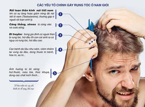 nguyên nhân rụng tóc hói đầu nam