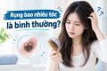 [Góc giải đáp] Rụng bao nhiêu tóc là bình thường?