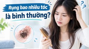 [Góc giải đáp] Rụng bao nhiêu tóc là bình thường?