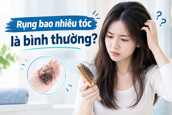 [Góc giải đáp] Rụng bao nhiêu tóc là bình thường?