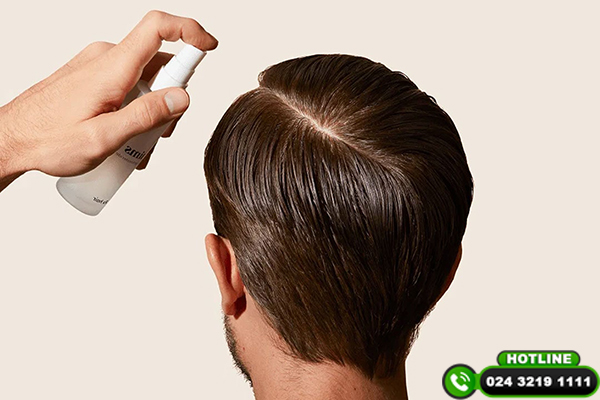 Tổng hợp các cách trị hói đầu di truyền hiệu quả hiện nay