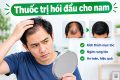 thuốc trị hói đầu cho nam được chuyên gia khuyên dùng