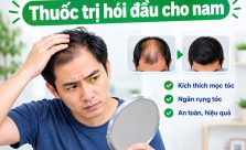 thuốc trị hói đầu cho nam được chuyên gia khuyên dùng
