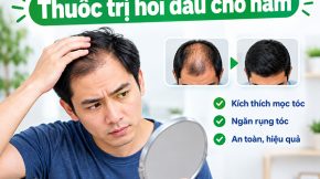 thuốc trị hói đầu cho nam được chuyên gia khuyên dùng