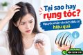 Tại sao hay rụng tóc? Nguyên nhân và cách điều trị hiệu quả