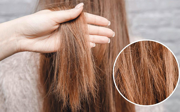 vì sao tóc chẻ ngon và gãy rụng