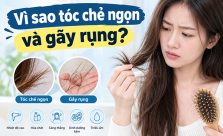 Vì sao tóc chẻ ngọn và gãy rụng? 7 nguyên nhân bạn cần biết